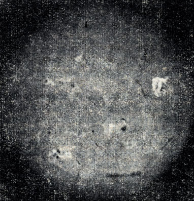 Рис. 28. Хромосферная вспышка 3 июля 1957 г., сфотографированная в лучах Нα.